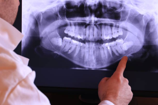 Best Emergency Dental Services for Seniors in Union Springs, AL