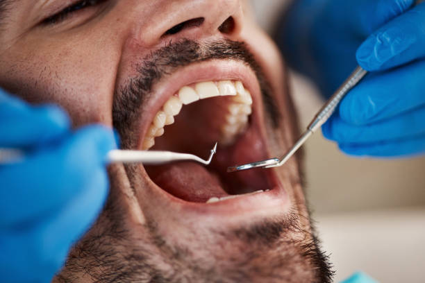 Best Emergency Dental Care for Abscessed Tooth in Union Springs, AL